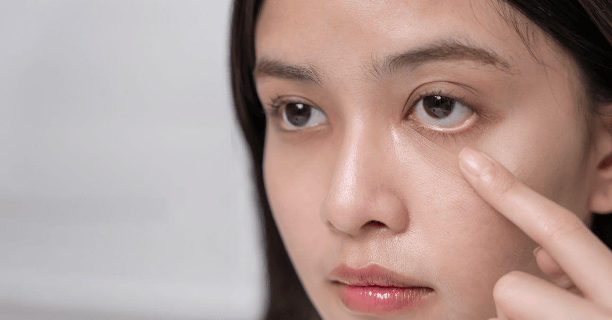 Woman experiencing eye redness and irritation, a common symptom of eye infection complications